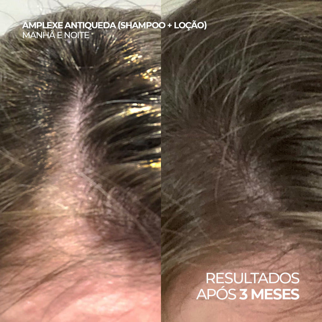 Shampoo Antiqueda Pró-Crescimento com Copper Tripeptide-1, Cafeína e Carnitina – Amplexe Shampoo Antiqueda 250ML