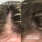 Shampoo Antiqueda Pró-Crescimento com Copper Tripeptide-1, Cafeína e Carnitina – Amplexe Shampoo Antiqueda 250ML
