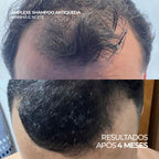 Shampoo Antiqueda Pró-Crescimento com Copper Tripeptide-1, Cafeína e Carnitina – Amplexe Shampoo Antiqueda 250ML