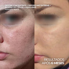 Kit para Pele Oleosa com Protetor Solar Matte FPS 50 + Hidratante Anti-Oleosidade